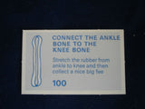 MB Operation game - spare parts - money - cards - body parts